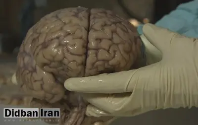 علم چه می‌گوید؛ آیا ما فقط از ۱۰ درصد توان مغز خود استفاده می‌کنیم؟