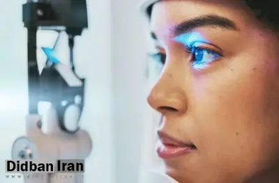 جایگزینی برای لیزیک؛ روش جدید محققان بدون برش، چشم را اصلاح میکند
