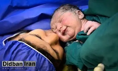 افزایش ۱۰ برابری تعداد سزارین در سه بیمارستان تهران برای تولدهای ١۴٠١/١/١