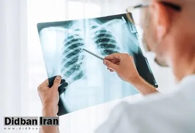 چرا آنفلوآنزا گاهی کشنده می‌شود؟