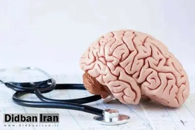 در دنیا هر ۳ ثانیه و در ایران، هر ۷ دقیقه یک نفر به آلزایمر مبتلا میشود