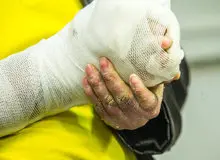 مدیرعامل بنیاد بیماری‌های نادر: از ۳۷۰ نوع بیماری نادر تنها ۲۲ مورد تحت پوشش وزارت بهداشت هستند / قیمت هر بسته پانسمان یک میلیون و ۷۰۰ هزار تومان است؛ همین موضوع، بیماران را دچار مشکلاتی کرده