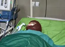 اسیدپاشی هولناک روی پدر و دختر