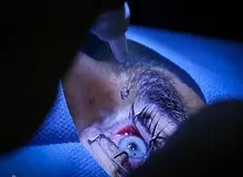 وزارت بهداشت: عمل تغییر رنگ چشم عوارض خطرناکی دارد