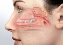 درمان‌ سه سوته گرفتگی بینی با ۱۰ ترفند ساده و خانگی