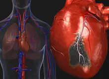 واقعیت  هایی درباره نارسایی قلبی