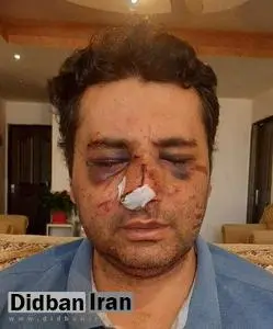 ضرب و شتم شدید یک متخصص بیهوشی توسط همراهان یک بیمار در پیرانشهر+تصاویر