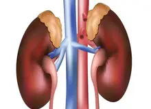 
عفونت، بلای‌ جان‌ کلیه‌ها