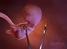 صدور بیش از ۹ هزار مجوز سقط درمانی در سال ۹۸
