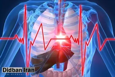 کسانی که قلبشان تیر می‌کشد، بخوانند