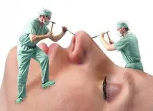 همزمان با جراحی زیبایی بینی این عمل را هم می‌شود انجام داد