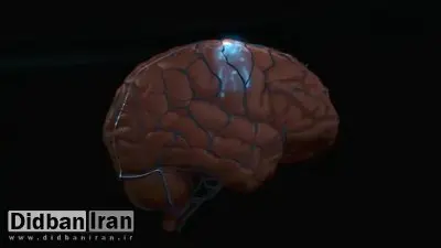 ضربه به سر ریسک مرگ زودهنگام را دو برابر افزایش می دهد