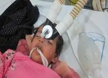 عقرب یک کودک خوزستانی را به کام مرگ فرستاد