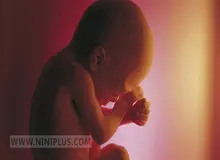 مدیرکل مرکز نظارت و اعتباربخشی امور درمان: بالای ۷۰ تا ۸۰ درصد سقط جنین‌های غیرقانونی در خارج از مراکز درمانی انجام می‌شود