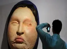 وقوع اسیدپاشی در افسریه تهران/ تحقیقات درباره صحت و سقم . انگیزه اسید پاش ادامه دارد