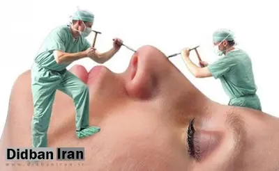 کاهش سن جراحی زیبایی به ۱۴ سال/ افزایش تقاضا در مردان و کهنسالان