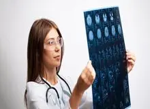 سکته‌ی مغزی می‌تواند بی‌درد باشد+ نشانه‌های خاموش سکته مغزی