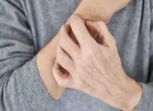 این نشانه‌ها یعنی بیماری پوستی