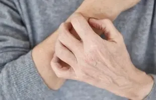 این نشانه‌ها یعنی بیماری پوستی