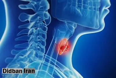 نشانه های یک بیماری پنهان؛ افزایش وزن و احساس سرما