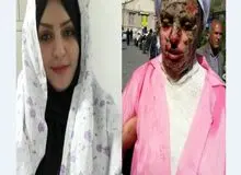 آخرین وضعیت درمانی معصومه/ «اسید» تمام نسوج عمقی سر و صورت او را سوزانده است
