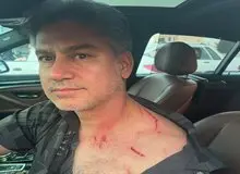 حمله سارقان موتورسوار به مربی تیم ملی در بزرگراه مدرس+ تصویر