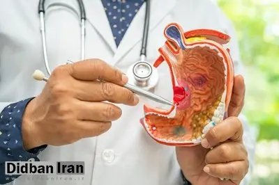 نقش پنهان آلودگی هوا در افزایش خطر بک نوع سرطان