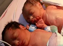 مرخصی زایمان برای مادران شاغل صاحب دوقلو و بیشتر یک ساله شد