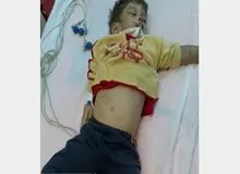 مرگ پسر 4 ساله زیر شکنجه های خاله معتاد+عکس