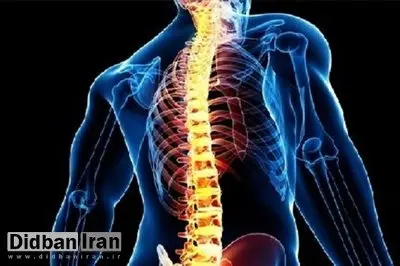 افزایش درد و مشکلات ستون فقرات در نسل جوان
