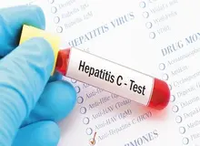 معاون بهداشت وزارت بهداشت: درمان بیماری هپاتیت C رایگان است