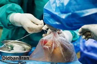 اعضای بدن بانوی ۵۲ ساله کنگانی اهدا شد