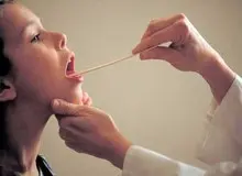 هشت راه حل برای درمان گلو درد 