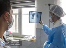 بیش از ۳۰ درصد بیماران مبتلا به کرونا علائم عصبی دارند/ کمبود اکسیژن خون می‌تواند منجر به اختلال در عملکرد مغز شود