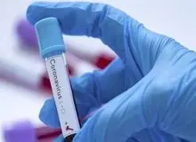 آیا می توان به تاثیر گرما بر نابودی کرونا امیدوار بود؟