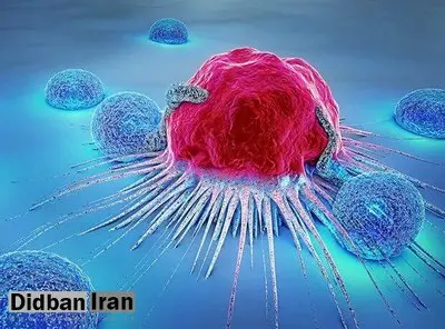 هر ۳۰ تا ۴۰ دقیقه، یک زن ایرانی دچار سرطان سینه می‌شود