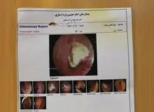 کشفی که راز دردهای 10 ساله یک زن را برملا ساخت