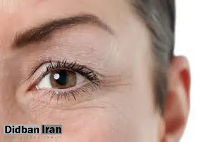چین و چروکهای صورت درباره کدام بیماریها هشدار میدهند؟