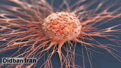 پیاده روی روشی کاهش خطر ابتلا به سرطان