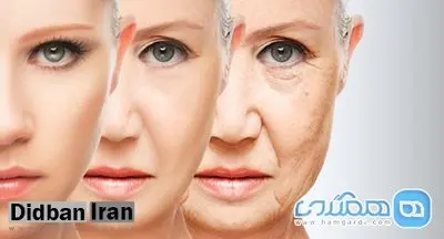 جوان سازی دور چشم فقط در 1 دقیقه!