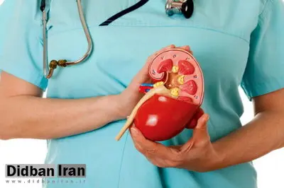 ۴ نشانه مهم ابتلا به سنگ کلیه را بشناسید