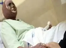 اسیدپاشی مرد ۲۸ ساله روی همسرش در استان گیلان