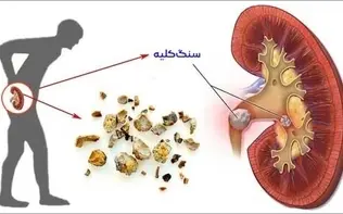 چه داروهایی برای کلیه پر خطر هستند
