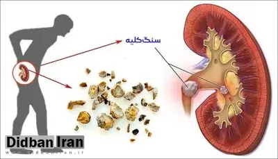 چه داروهایی برای کلیه پر خطر هستند