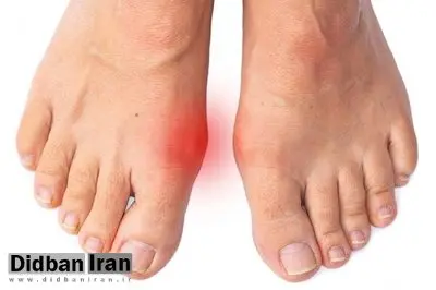درد شست پا میتواند نشانه بیماریهای جدی باشد