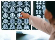 کرونا چگونه از بینی به مغز منتقل می‌شود؟