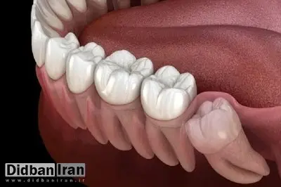 با خواندن این دلیل حتما سراغ مسواک و نخ دندان می‌روید