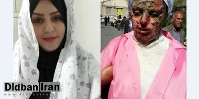 دانشگاه علوم پزشکی تبریز: هزینه‎ای برای درمان قربانی اسیدپاشی دریافت نشده است