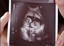 علوم پزشکی: از بین ۵۰۰ هزار سقط جنین تنها ۱۰ هزار سقط قانونی بوده است