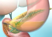 مصرف روزانه آسپرین ریسک سرطان لوزالمعده را کاهش می دهد